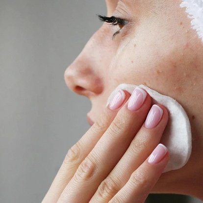 oplossingen-hormonale-acne