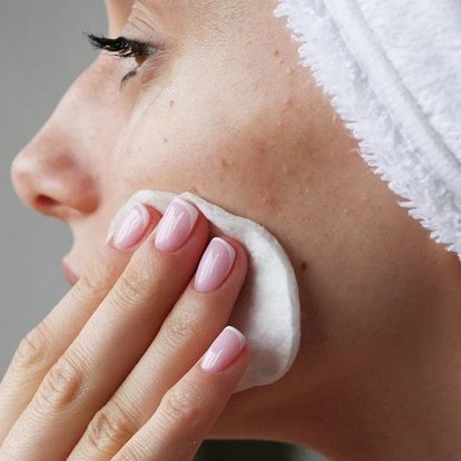 oplossingen-hormonale-acne
