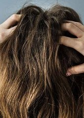 haarverzorging hoofdhuid