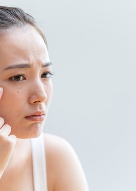 how-air-pollution-might-be-causing-your-blemishes