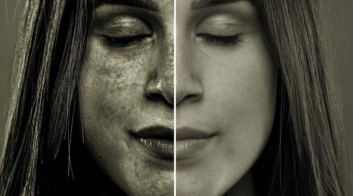 huidveroudering-door-zon